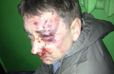 Группа неизвестных избила до полусмерти одного из организаторов Майдана в Сумах, корреспондента Положия