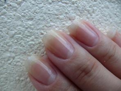Как восстановить поврежденные ногти 