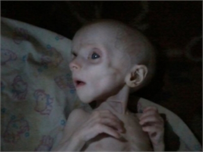 В Донецке младенец умер от истощения
