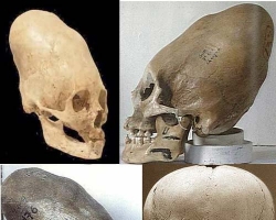 Найдены скелеты с вытянутыми, как у киношных пришельцев, черепами
