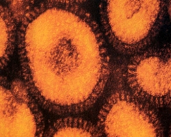 Смертельно опасный грипп движется на Украину из США